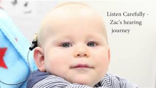 Cochlear Implant - surgery, wound check, switch on