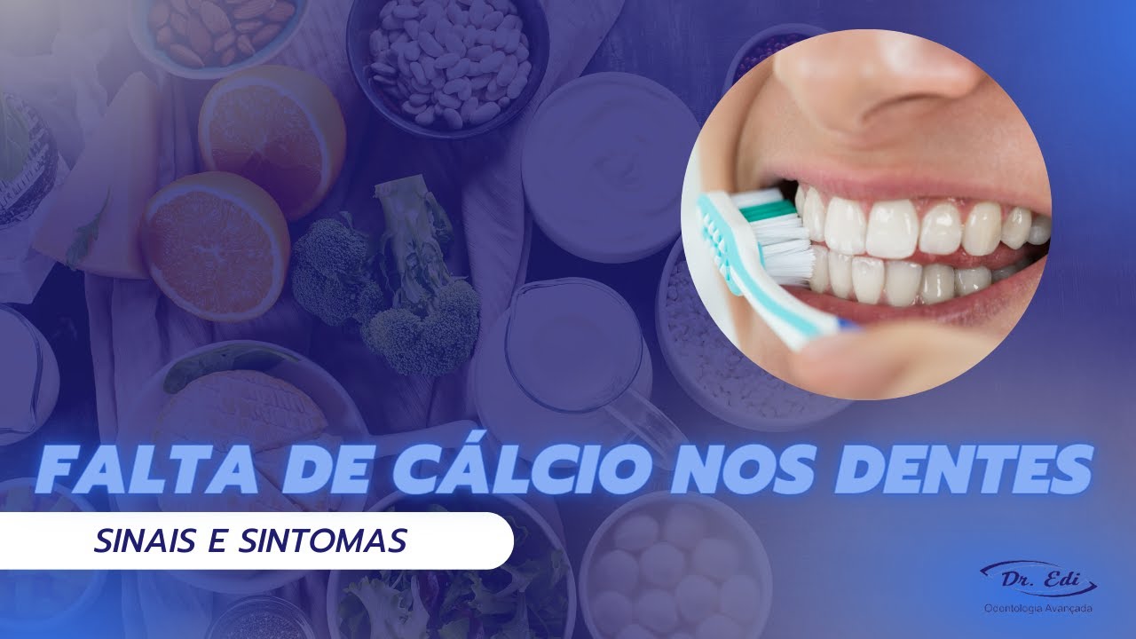 Falta de cálcio nos dentes, quais são os sinais e sintomas? - YouTube
