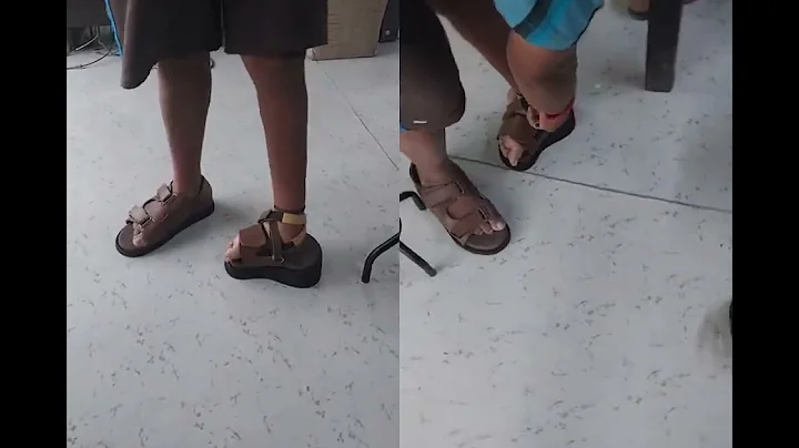 Moulded Footwear for physically handicapped (polio adult clubfoot twisted feet) My Care Prosthetics