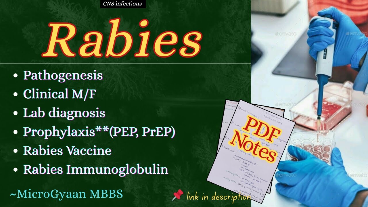 Rabies in Microbiology | Rabies Vaccine | Rabies prophylaxis | CNS infections | MicroGyaan MBBS 