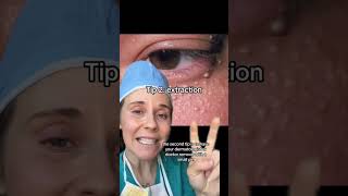3 Dermatologist tips for removing milia, the small bumps that are common on eyelid skin. #milia