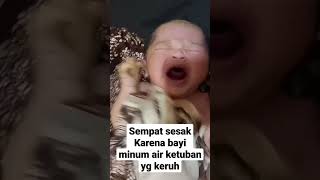 Download Lagu AIR KETUBAN KERUH || BAYI SEMPAT SESAK NAPAS MP3
