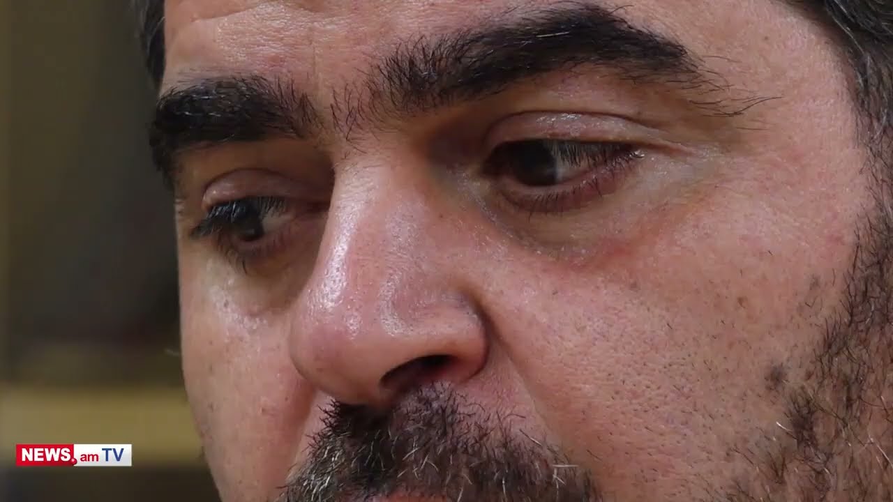 Մանկական օրթոպեդիայի ժամանակակից մեթոդները «Արաբկիր» ԲՀ-ում.  Վահե Յավրյան