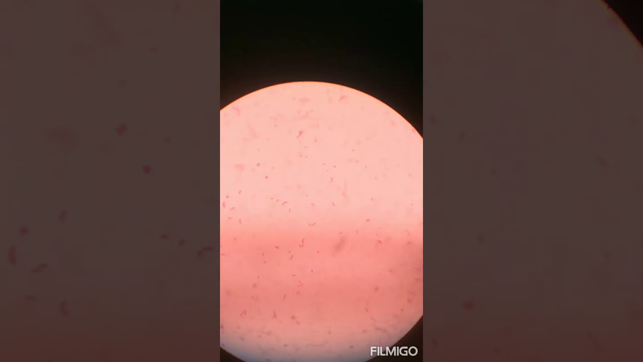 Mycoplasma galisepticum microscopic observation