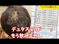 デュタステリドからフィナステリドに戻した理由… デュタの副作用で注意したいこと。