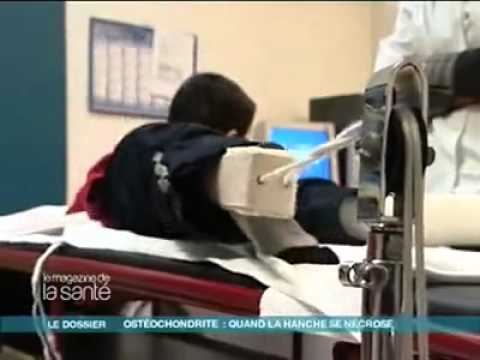 Vidéo: Traitement De L'ostéochondrose