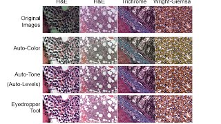 Webinar: A Better Choice than Photoshop for Color Brightfield Microscope Images