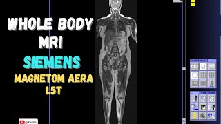 Whole Body MRI Technique | SIEMENS - Magnetom Aera 1.5 T | Syngo MR-D13 | Inline-Composing | Whole Body MRI Technique | SIEMENS - Magnetom Aera 1.5 T | Syngo MR-D13 | Inline-Composing |