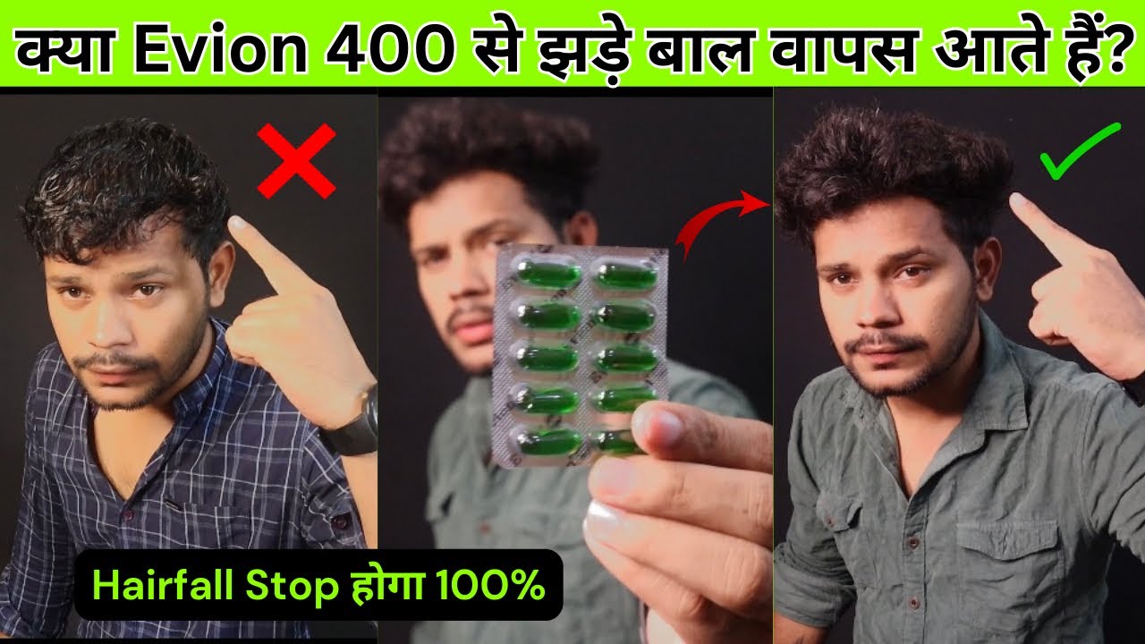 Evion 400 Vitamin E Capsules for Hair How to Use Vitamin E Capsule for hair Growth & Hair Fall