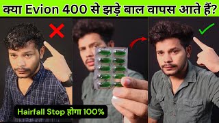 Evion 400 Vitamin E Capsules for Hair | How to Use Vitamin E Capsule for hair Growth & Hair Fall