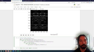 Image processing (16) | Image Filtering | Kernel convolution
