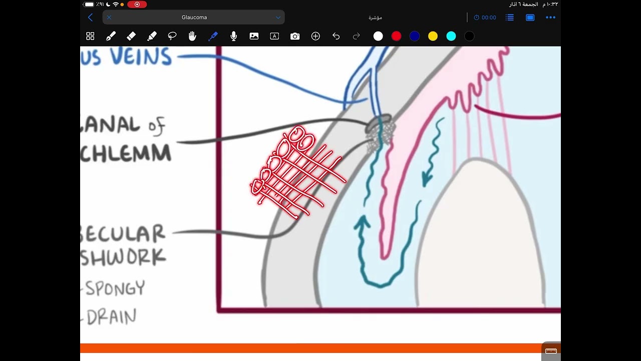Ophthalmology / Glaucoma