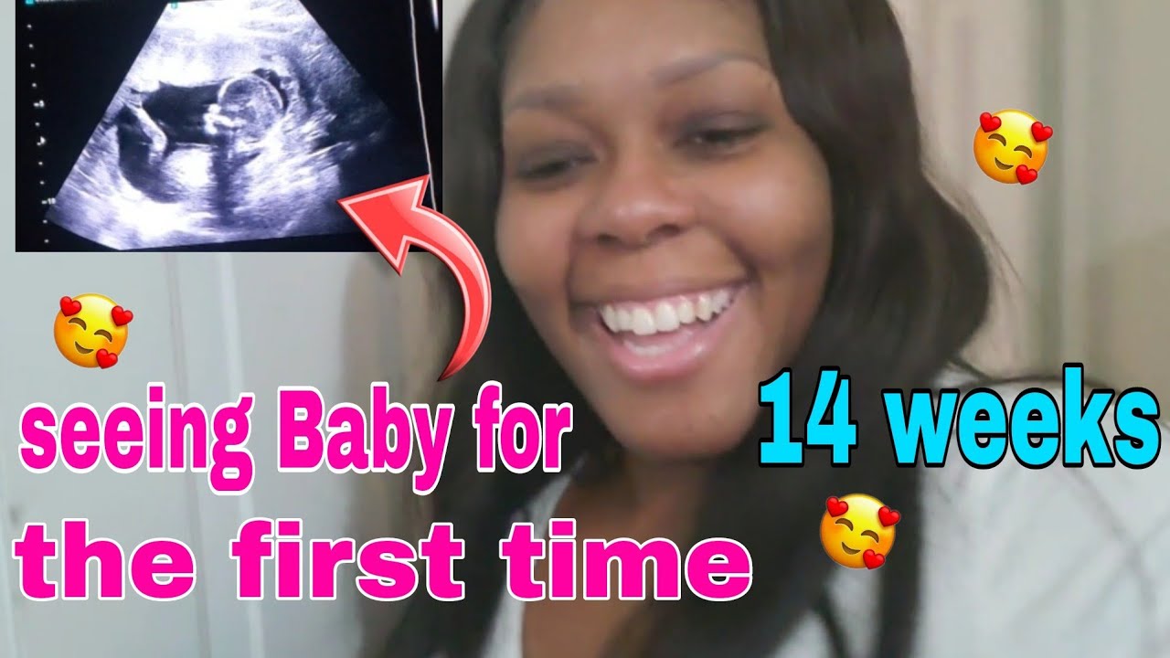 Ultrasound At 14 Weeks Do We Know The Gender YouTube ultrasound-at-14-weeks-do-we-know-the-gender-youtube