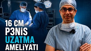 16 Cm P3Ni̇s Uzatma Ameli̇yati