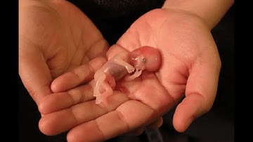 Missed Abortion CPT code - simplify medical coding