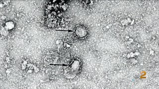 U.S. Coronavirus Infections Remain At 5 Cases