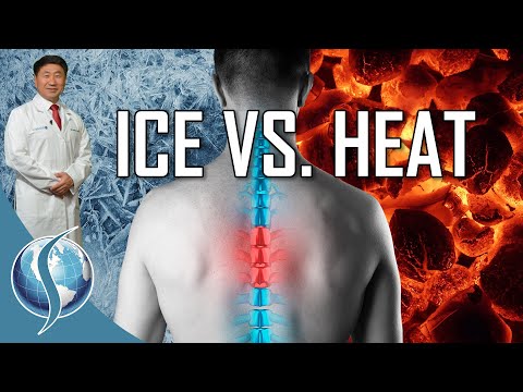Ice Versus Heat for Back Pain