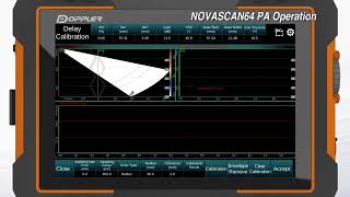 Celebrity NOVASCAN-V2 DETECTOR PHASED ARRAY OPERATION Wealth