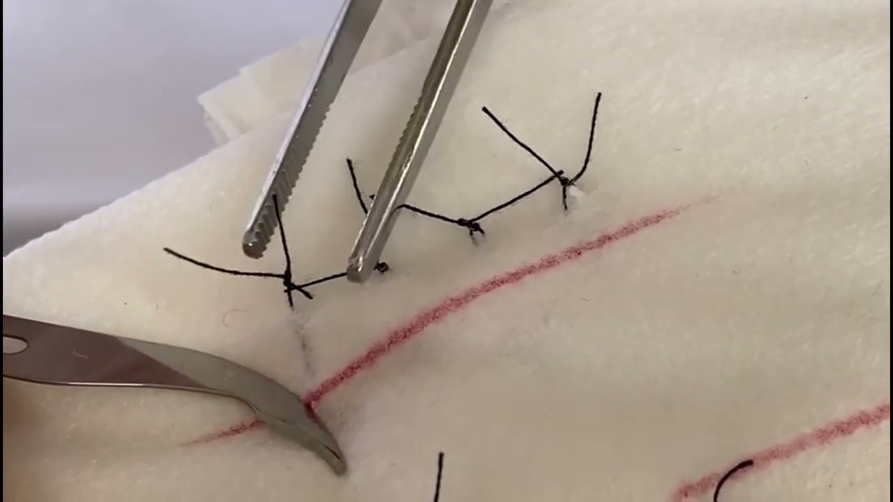 Alle soorten hechtingen verwijderen. Icdien