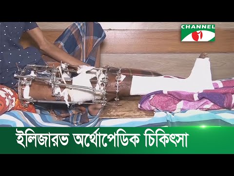 ভিডিও: আপনি কি পায়ের পাশের একটি হাড় ভাঙতে পারেন?