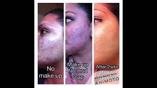 Amazing results from Seacret's Mud Soap with Minerals from the Dead Sea!!