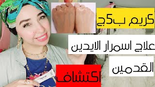 تفتيح اليدين والقدمين ونعومتهم مش هتصدقى النتيجة ب 5ج بس