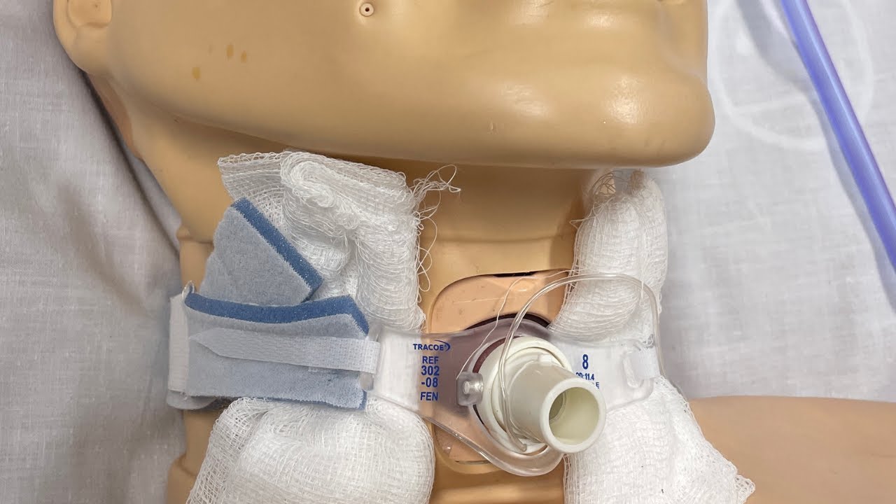 ازالة فتحة العنق