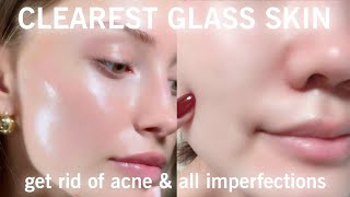 「experimental」DRASTICALLY CLEARER SKIN + get rid of acne & all imperfections {❌PURGING}