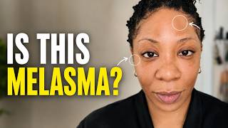 My Face Started Changing… Dermatologist-Recommended Melasma Routine for Dark Skin