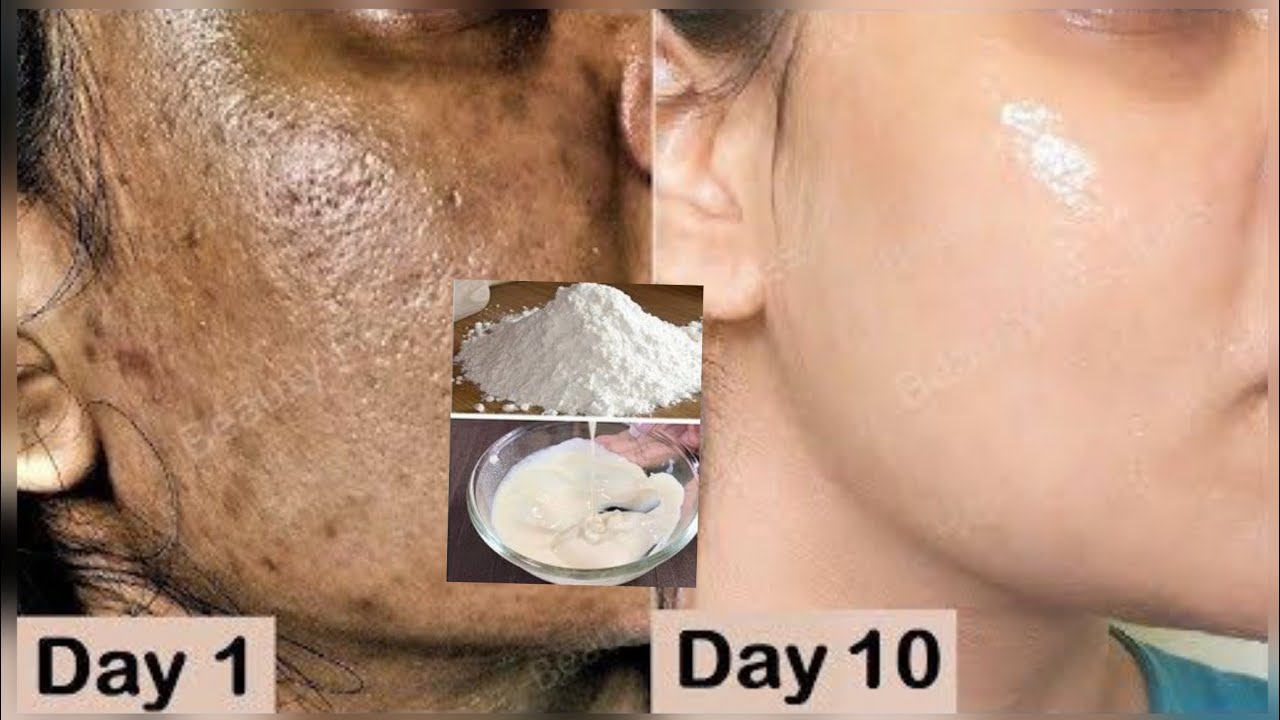 #aroos ama #umul #wajiga lagu #kobciyo easy to #remove #wrinkles try all #skin #type