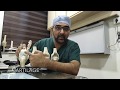 Why does knee pain occur? (In Hindi) - Patient Education Video