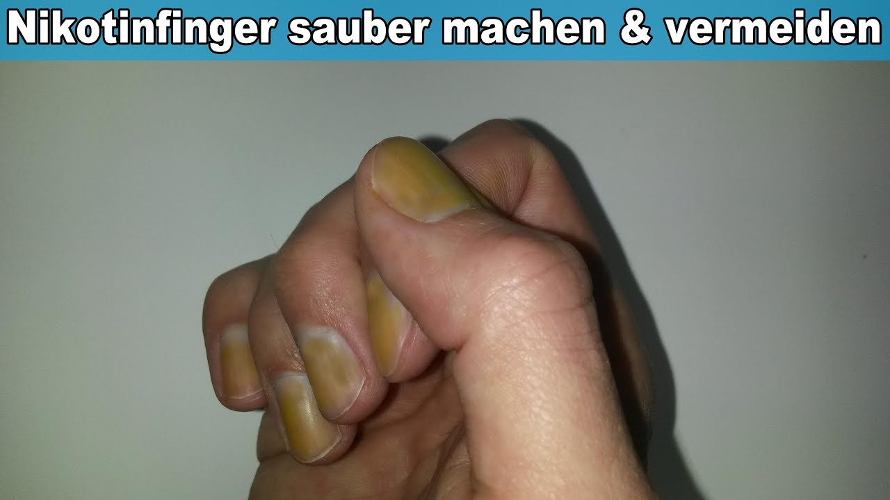 Wie Bekomme Ich Gelbe Fingernägel Wieder Weiß