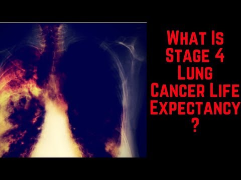 what-is-stage-4-lung-cancer-life-expectancy?