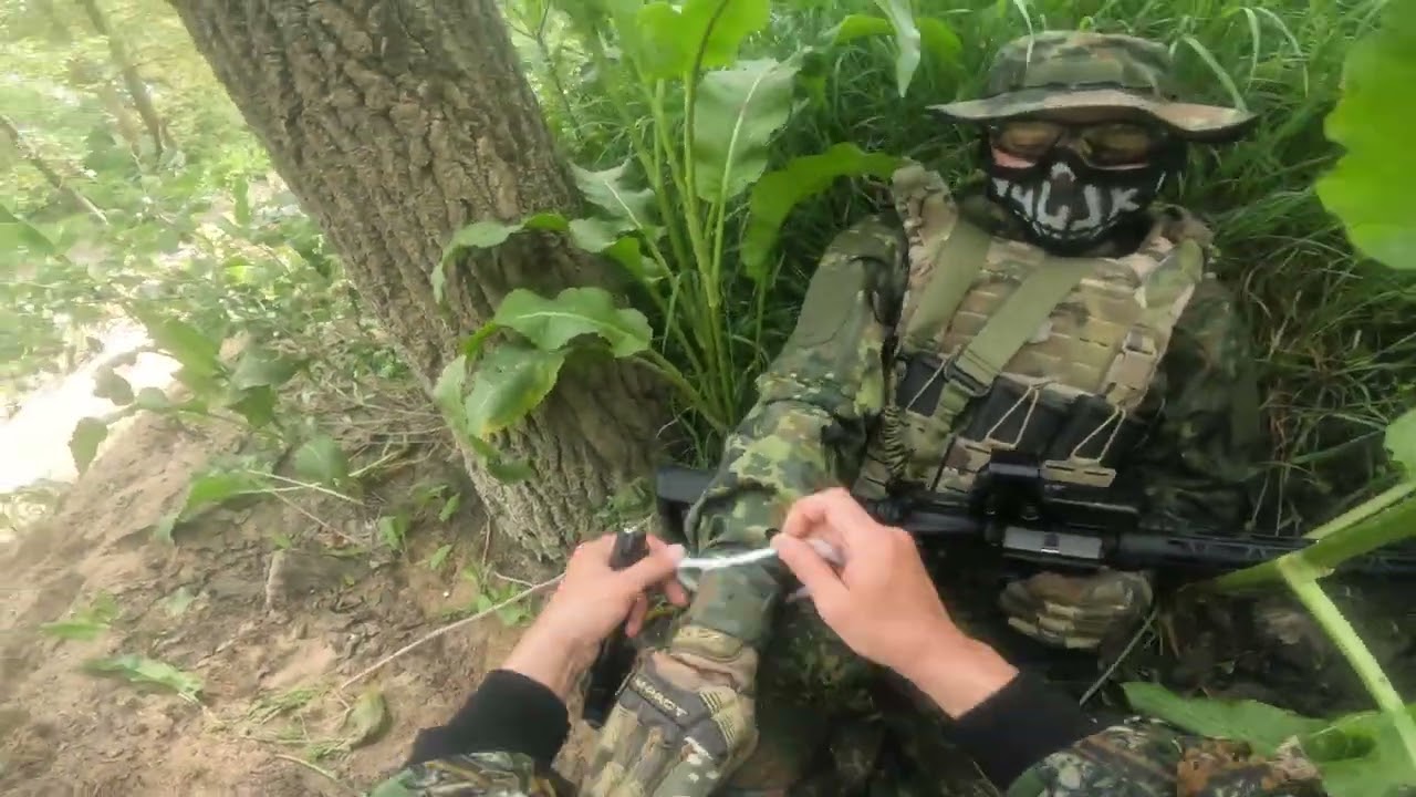 medico varios reivivs y diparo a herido sin quere