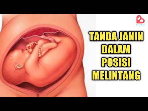 Video: Dalam maksud melintang?