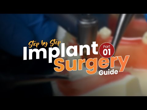 How to Place a Dental Implant | Step-by-Step Implant Surgery Guide | Part 1