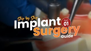 How to Place a Dental Implant | Step-by-Step Implant Surgery Guide | Part 1