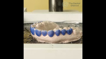 Teeth Whitening Trays: See how they are made! | The Dental District