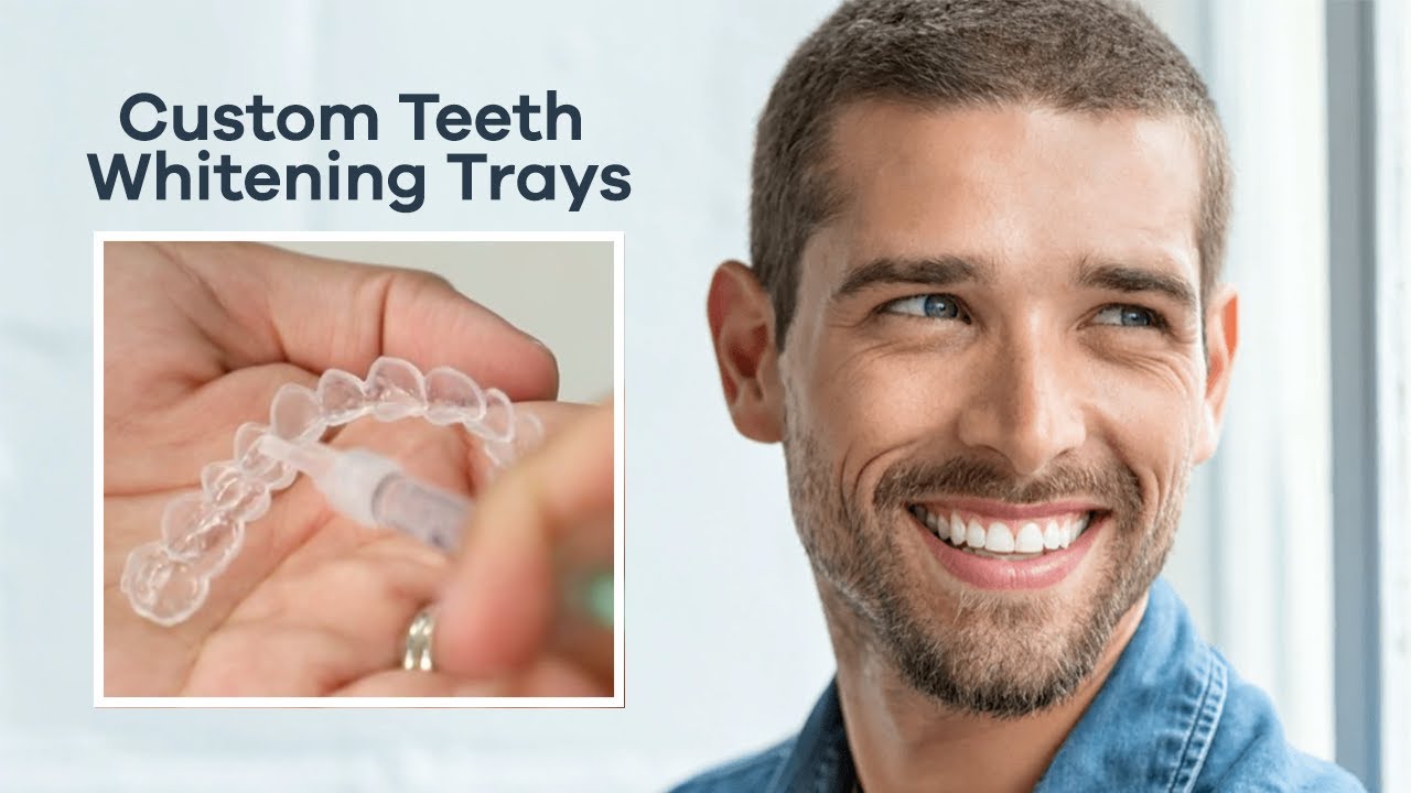 Teeth Whitening Trays: See how they are made! | The Dental District