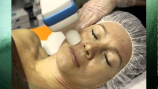 Transderm Meso System