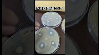 Part 2- Results of AST #microbiology #lablife #viralvideo #antimicrobialresistance#AMR #researchlife