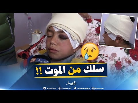 شاهد وحش بشري يضرب طفل بريئ ويترك له إصابات خطيرة