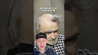 Hair Transplant Left Me Scarred For Life...