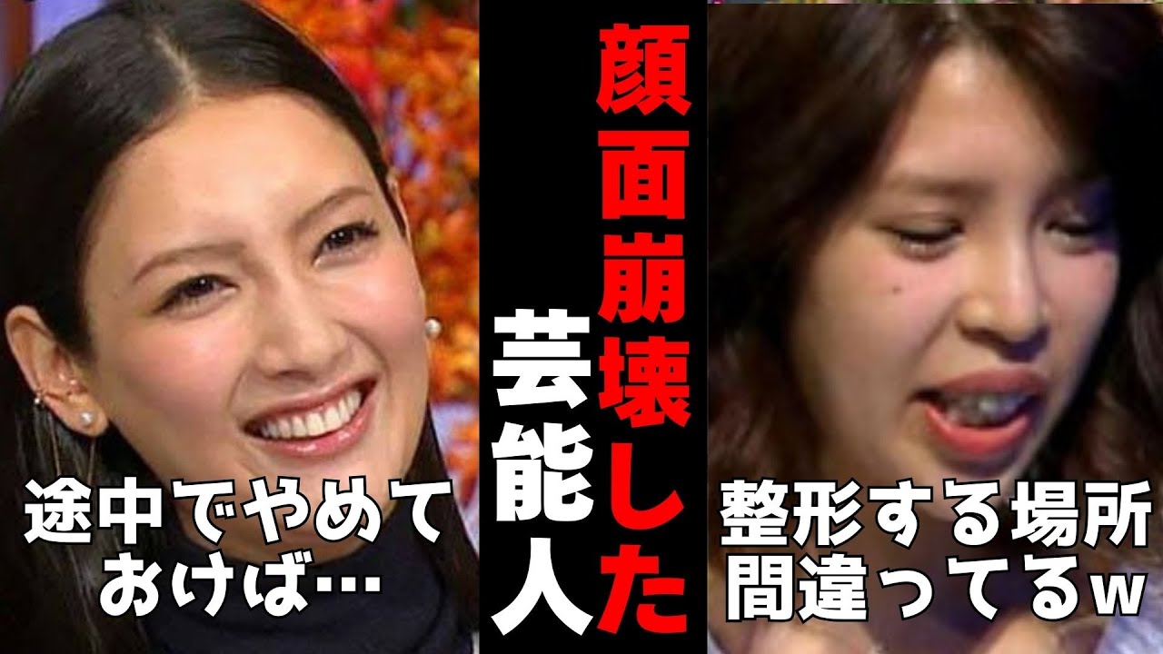 【有益2ch】美容医療やりすぎて顔面崩壊！整形しすぎた芸能人【ガルちゃん】