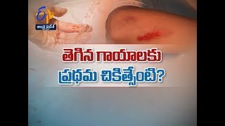 First aid for cuts and wounds | Sukhibhava | 22nd February 2020 | ETV Andhra Pradesh