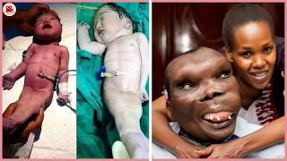 15 Extraordinary Lives Hidden Behind Unusual Appearances | Then and Now 2026