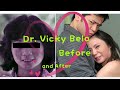 Ito Pala Noon Ang Itsura Ni Dr. Vicky Belo | Dr. Vicky Belo Before and After