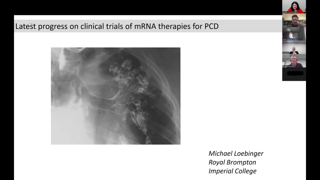 5- Latest progress on clinical trials of mRNA therapies for PCD - Michael Loebinger