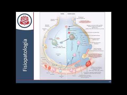 Video: Cómo prevenir el SDRA