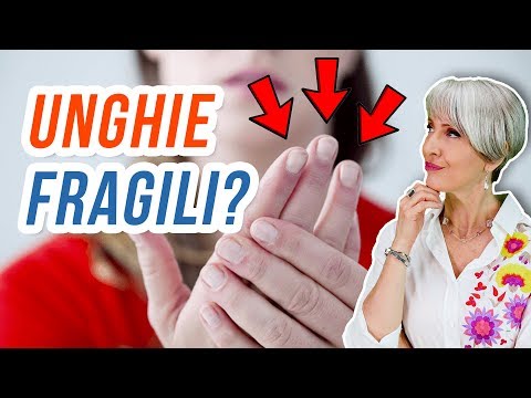 unghie-perfette-che-non-si-spezzano-con-questi-9-cibi-che-hai-in-casa